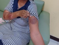 Kronologi Penyiksaan ART Cilacap di Yogyakarta