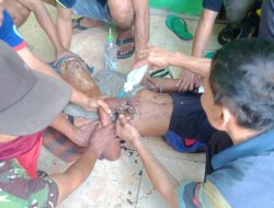 Bius Tangan Untuk Lepas Cincin