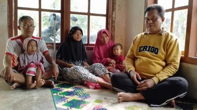 Gadis Cantik Terkena Tumor Tulang. Keluarga Kesulitan Biaya