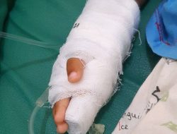 Balita Terkena TBC dan Gizi Buruk Diawasi Ketat