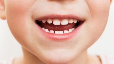 Menkes Temukan Penyakit Serius pada Anak Sekolah